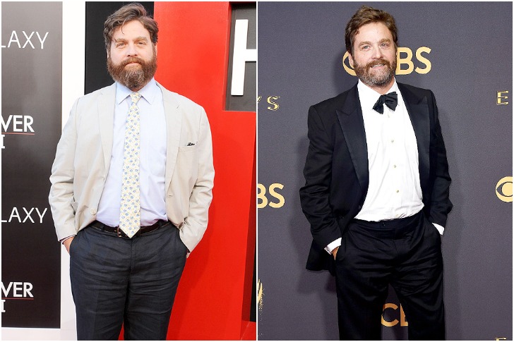 Zach Galifianakis, The Hangover, 50 Pounds