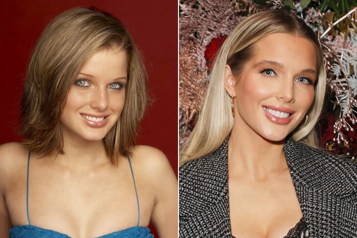 Helen Flanagan