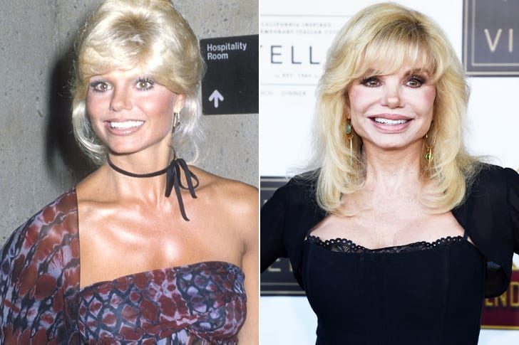 Loni Anderson – 76 Years Old