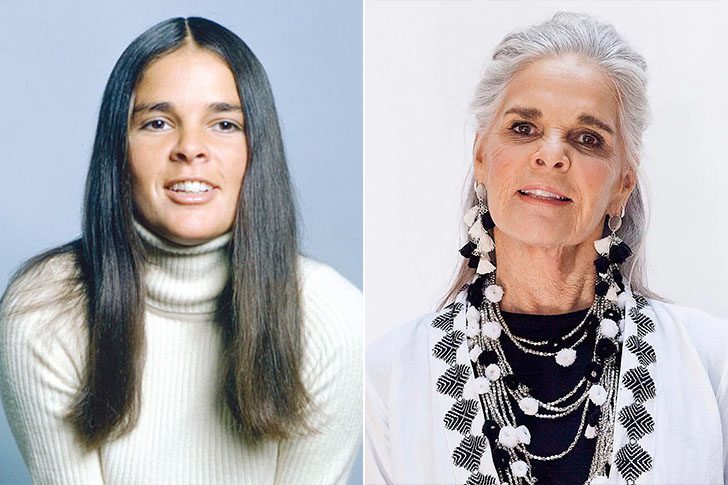 Ali MacGraw (Born In 1939) – Love Story