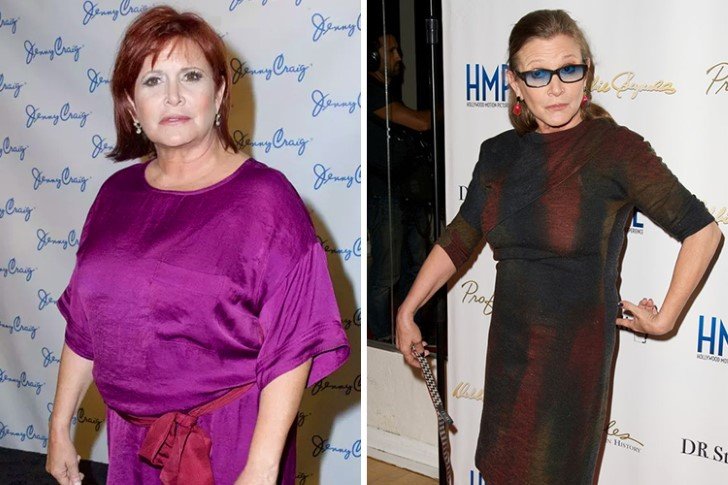 Carrie Fisher – 40lbs – Light Exercise & Small Diet Changes