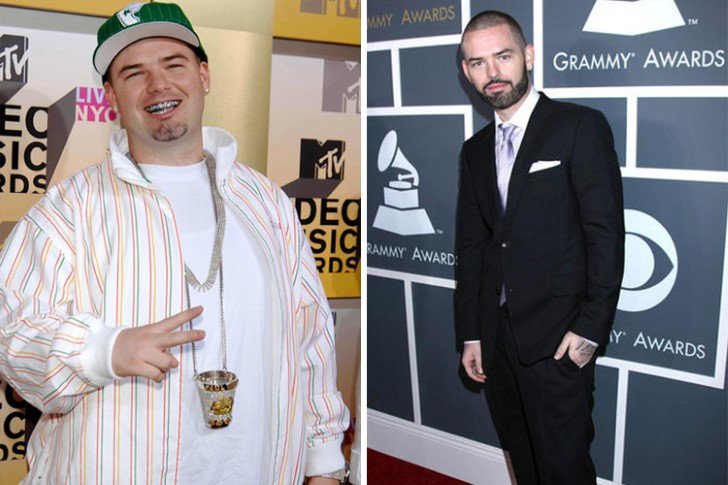 Paul Wall – 130lbs – Gastric Sleeve Surgery and Well-Balanced Diet