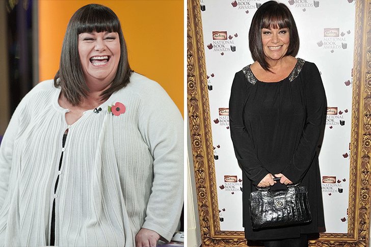 Dawn French – 98lbs – Long Walks & Healthier Diet