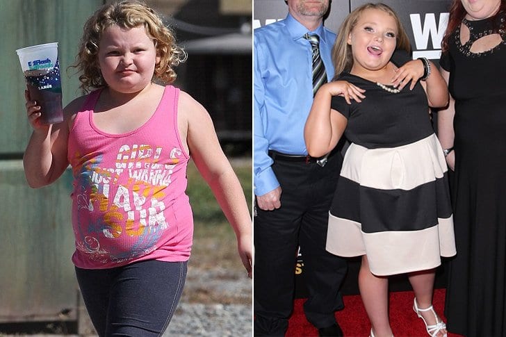 Alana “Honey Boo Boo” Thompson – Avoid Greasy Food and Adopt Healthy Lifestyle