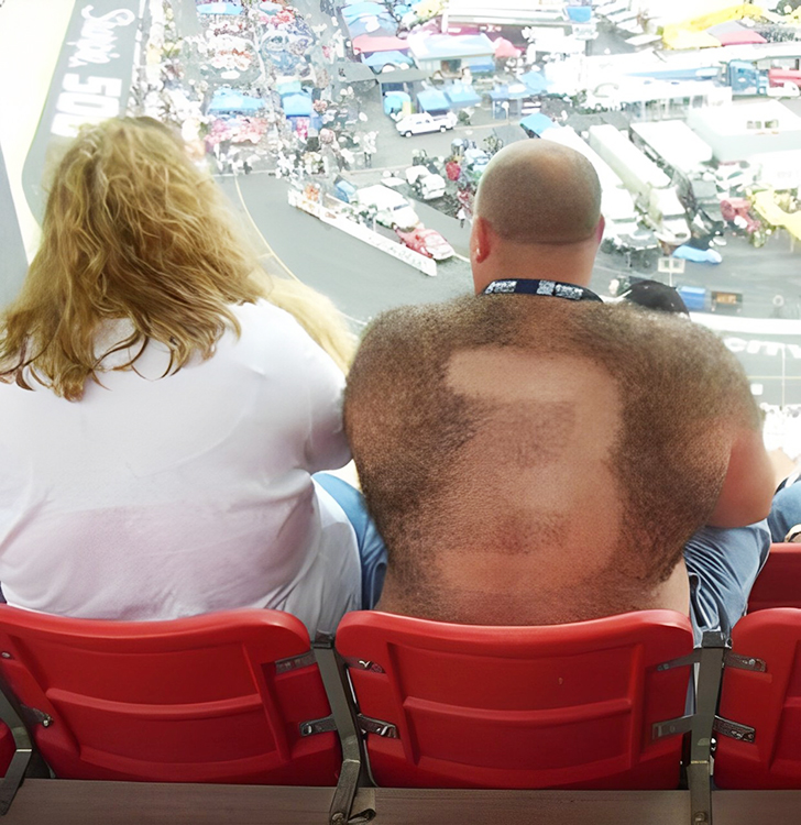 Hairy Superfan: Shaved Back Art Shows True Dedication to the Race!