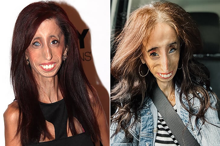 Lizzie Velásquez, Born In 1989 – A Brave Heart: The Lizzie Velásquez Story